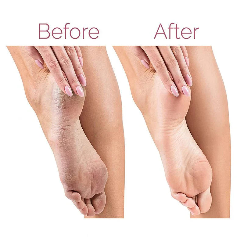 Foot Scrub Dirt Remover™ – Premium Foot Cleaning Brush